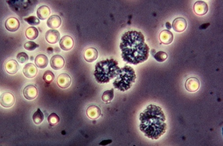 Pasteuria ramosa spores By Dieter Ebert, Basel, Switzerland (Own work) [CC BY-SA 4.0 (http://creativecommons.org/licenses/by-sa/4.0)], via Wikimedia Commons